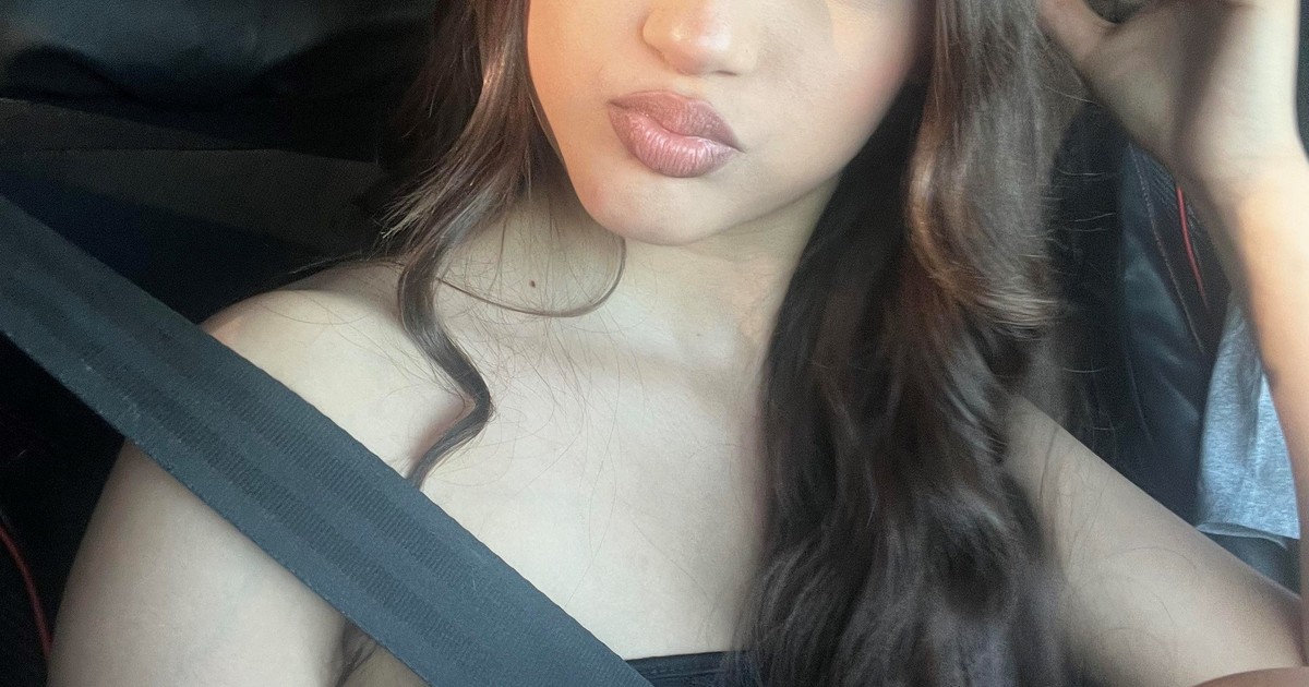 Una adolescente quedó irreconocible tras un brutal ataque de 10 perros y 500 puntos de sutura: «¿Sigo siendo bonita?»