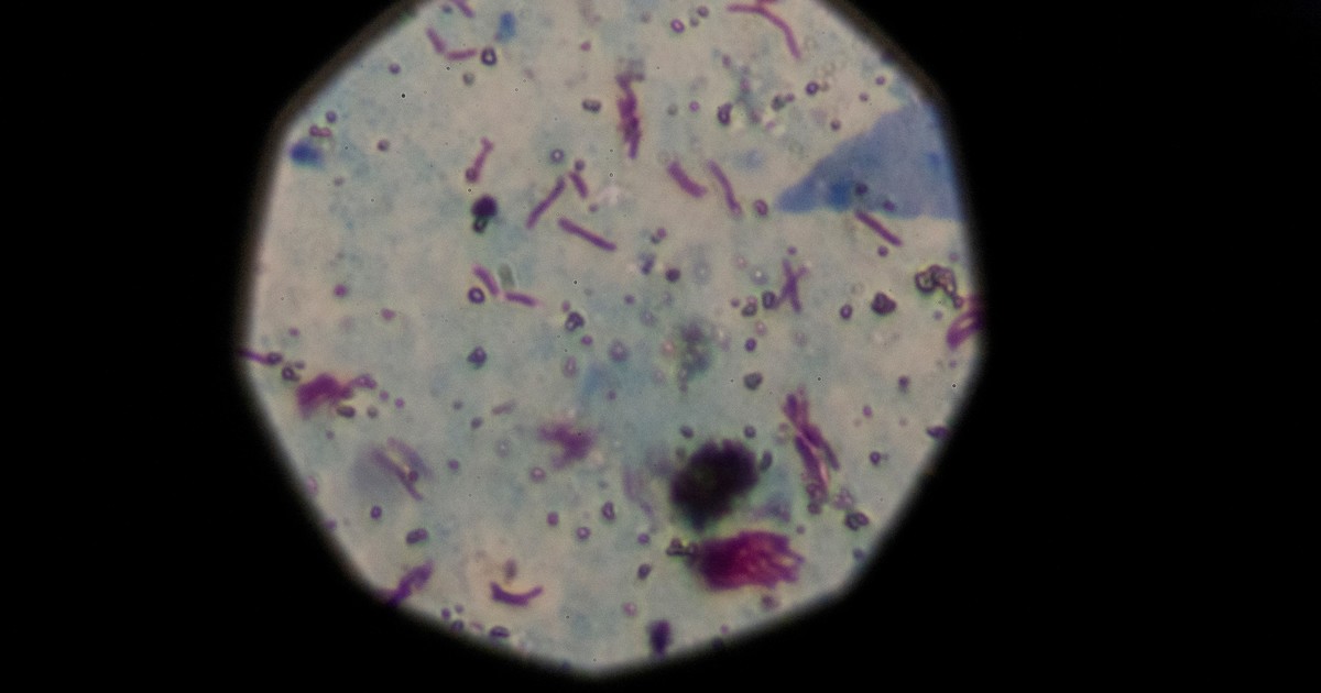 La vacuna contra la tuberculosis: todo lo que debes saber