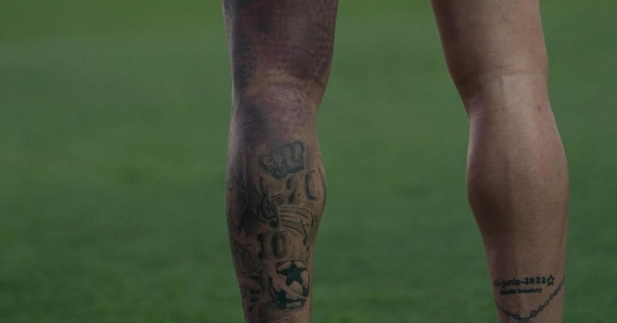 La impactante imagen del moretón de Rodrigo De Paul: ¿llega al amistoso de la Selección en la Bombonera?