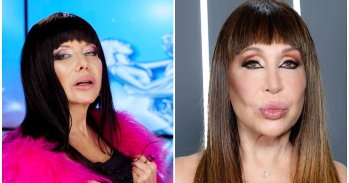 Cecilia Roth reveló el accidente doméstico que sufrió durante el rodaje de la serie de Moria Casán: “Me dieron nueve puntos”